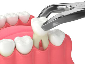 Cirurgia oral