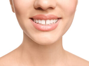 diastema