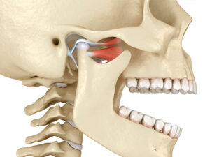disfunção temporomandibular